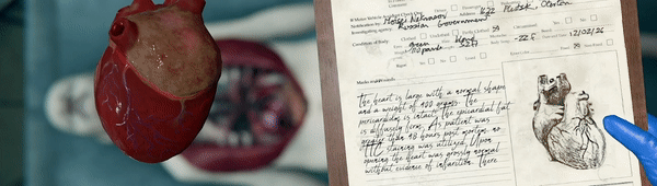 图片[3]-【模拟SLG/中文/猎奇】验尸模拟器 Autopsy Simulator 官方中文硬盘版【15.6G】-嘤嘤怪之家